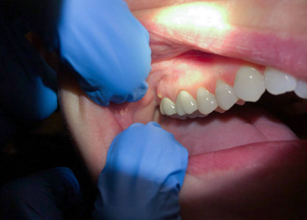 Best Emergency Broken Tooth Repair in Lake Park, IA